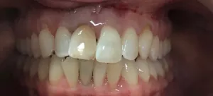 Complex dental case before photo