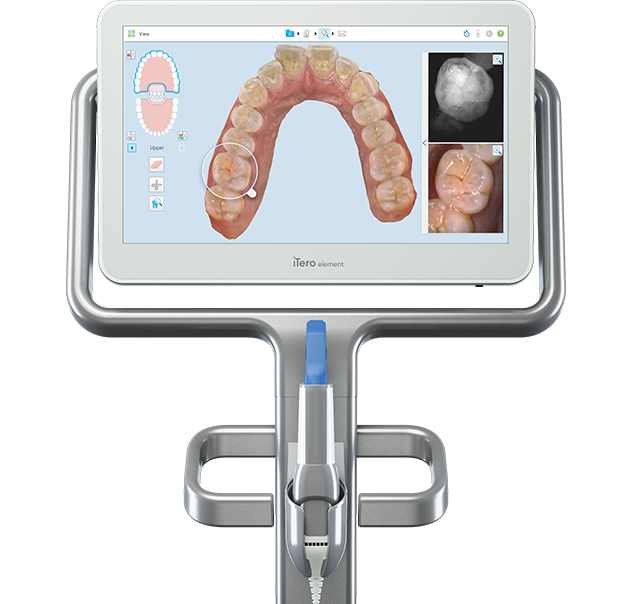 Intraoral scanner